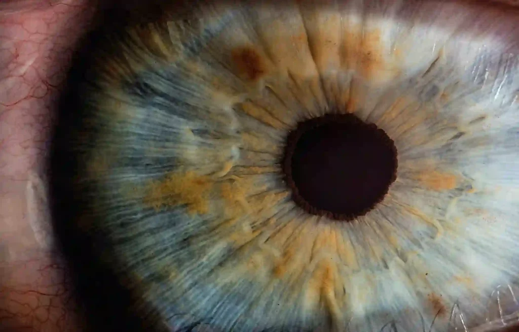 Eye cornea closeup